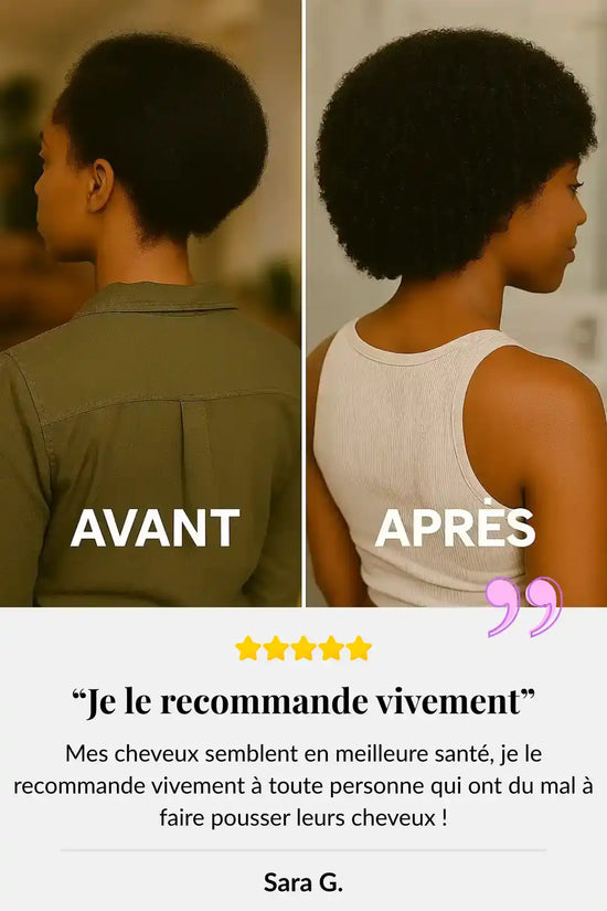 Une comparaison côte à côte des cheveux d'une femme avant et après un traitement, montrant une croissance capillaire significative et une santé améliorée.